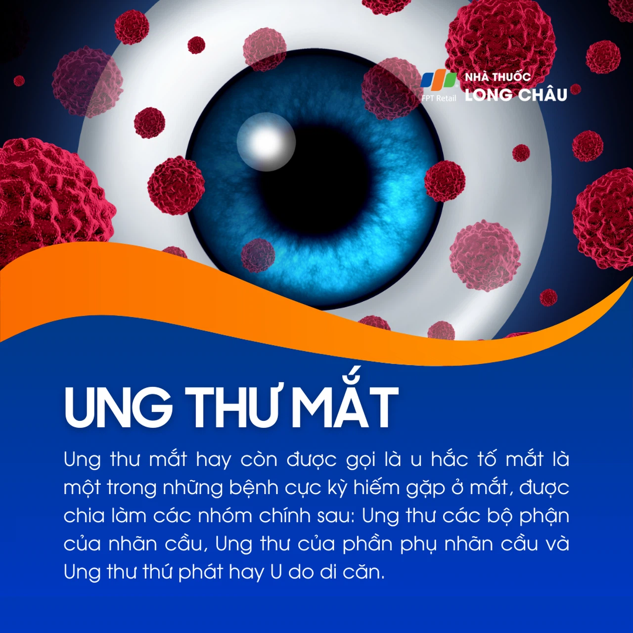 Ung thư mắt 1