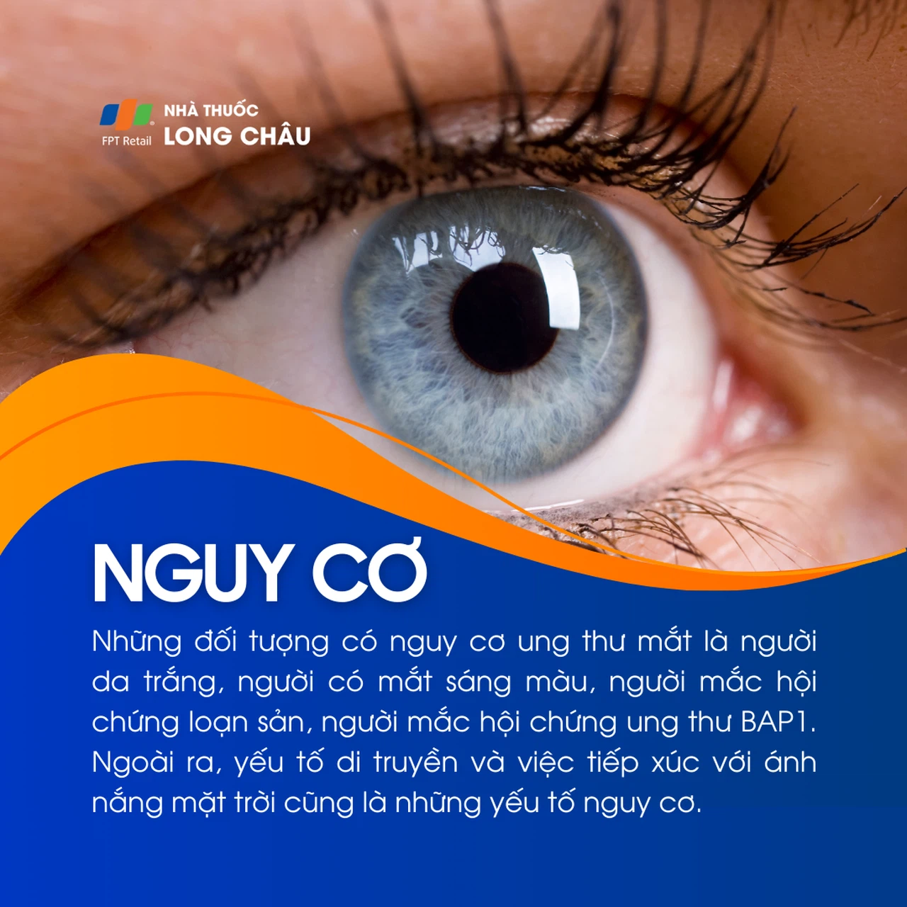 Ung thư mắt 4