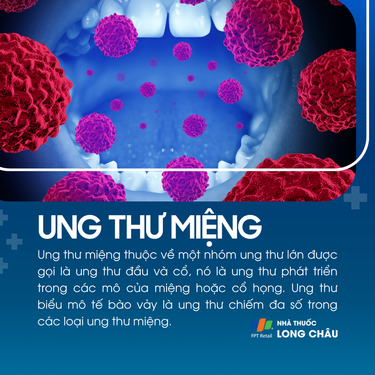 Ung thư miệng 1