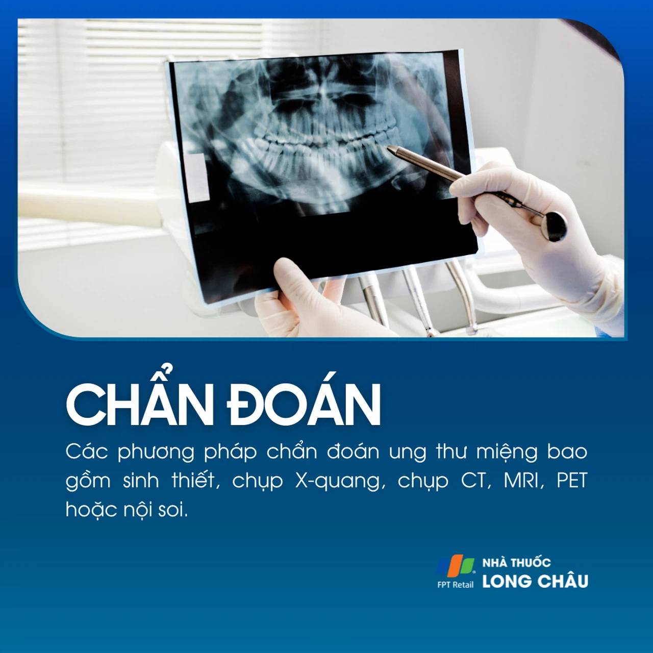 Ung thư miệng 5