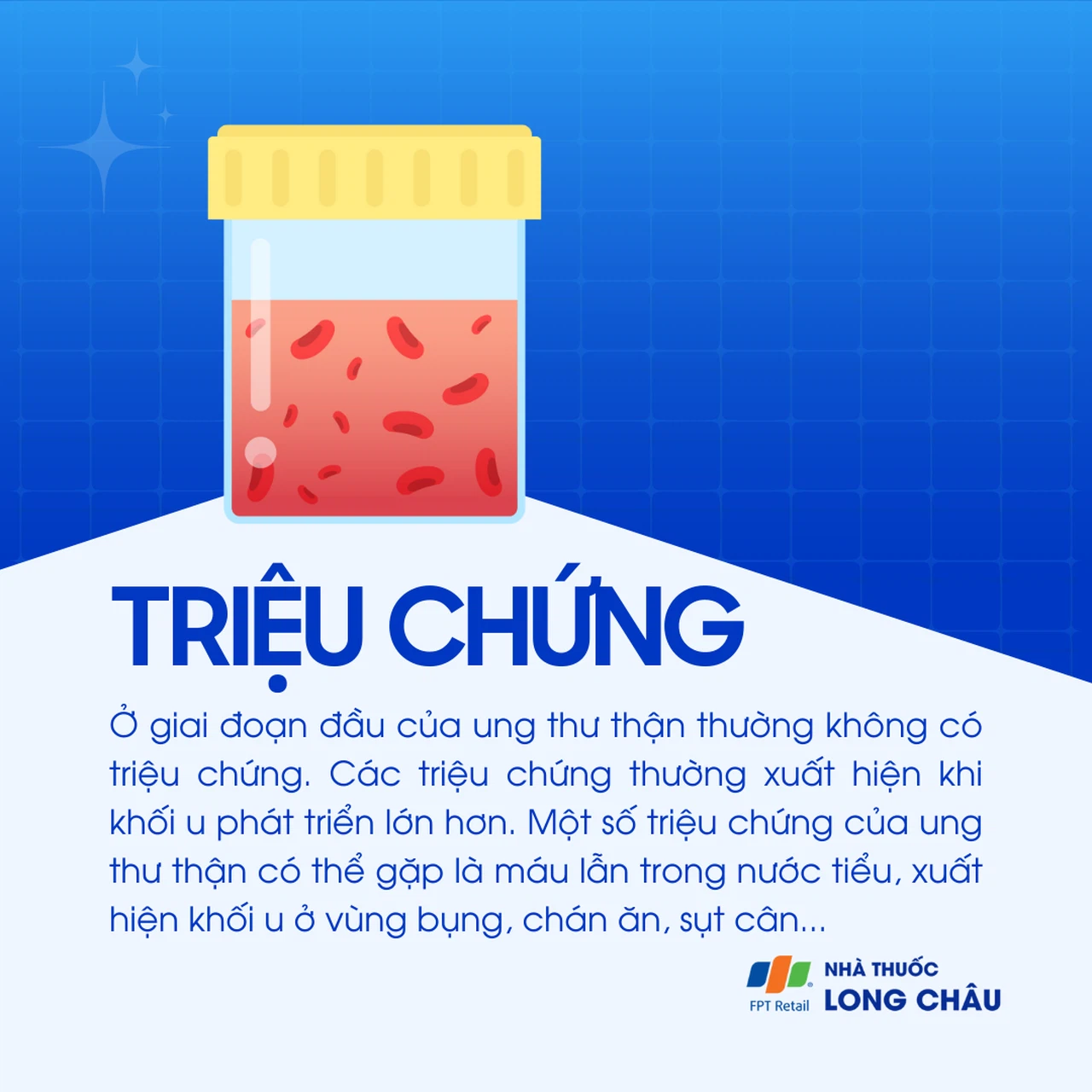 Ung thư thận 2