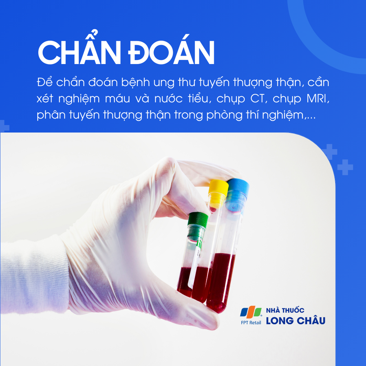 Ung thư tuyến thượng thận 5
