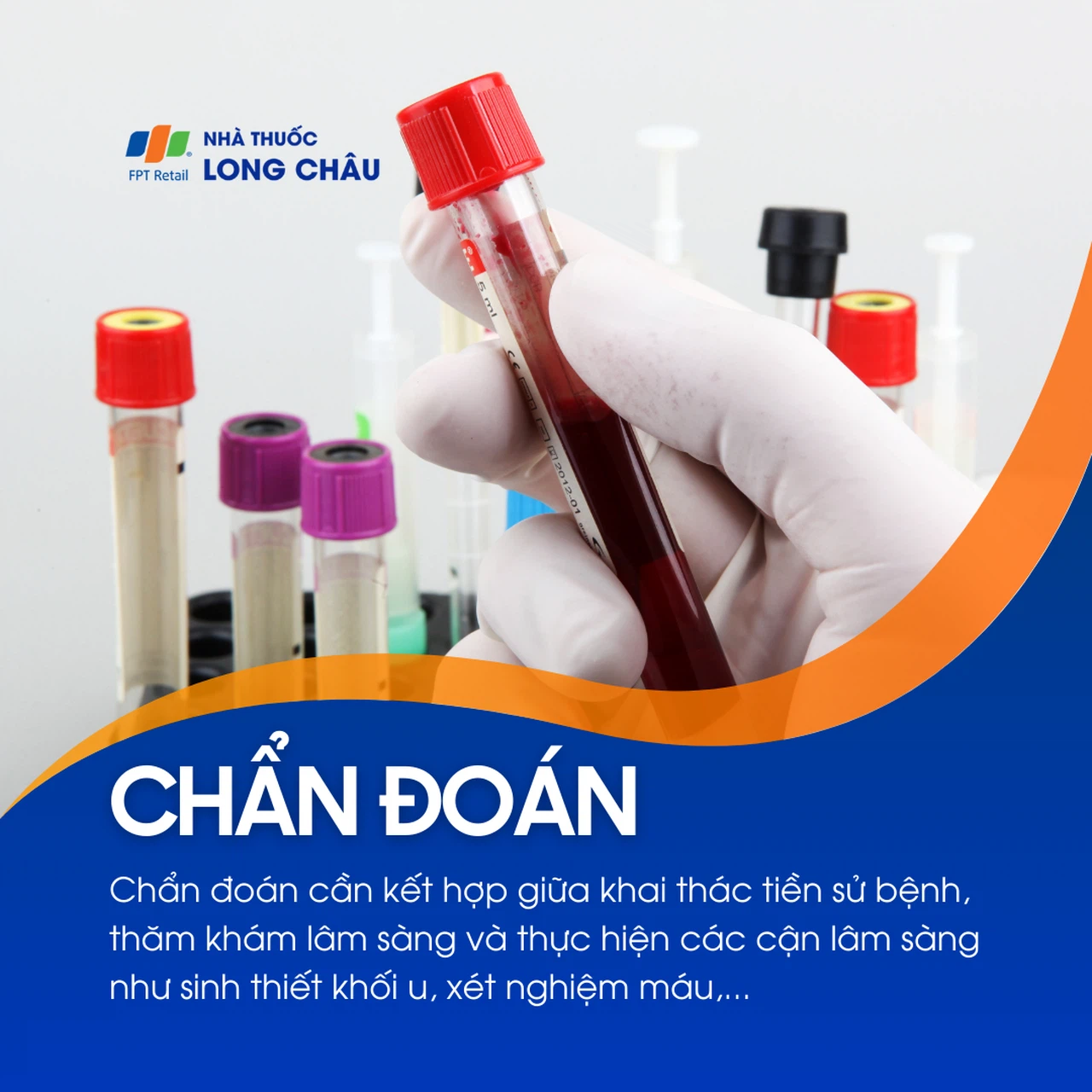 Ung thư xoang 5