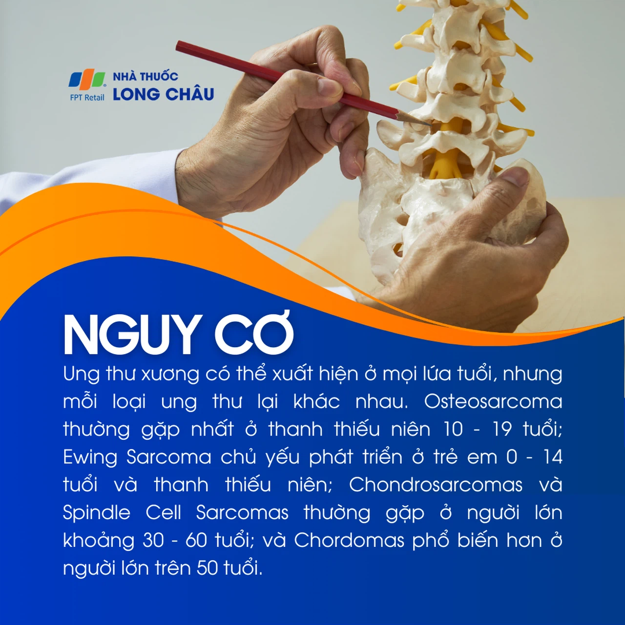 Ung thư xương 4