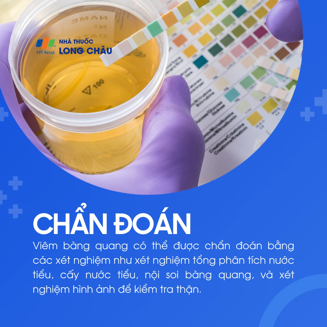 Viêm bàng quang 5