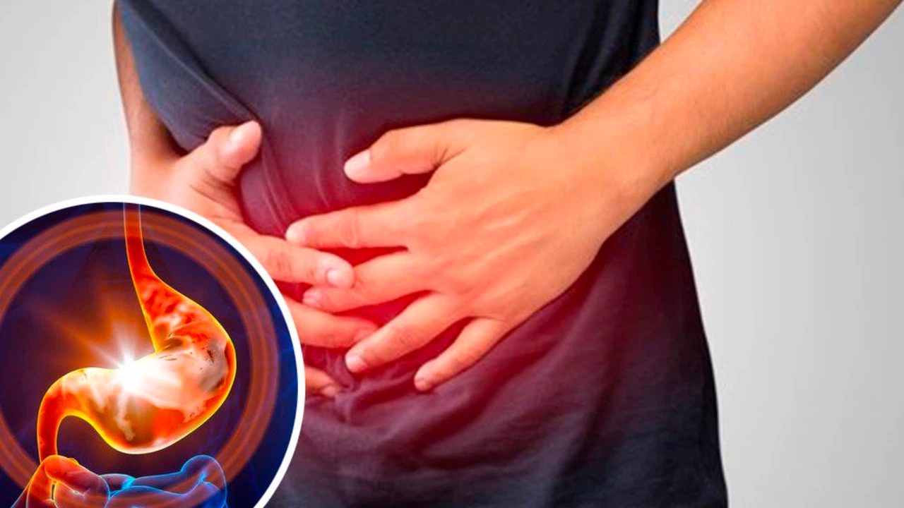 Viêm dạ dày mạn tính là gì? Nguyên nhân, triệu chứng và cách điều trị