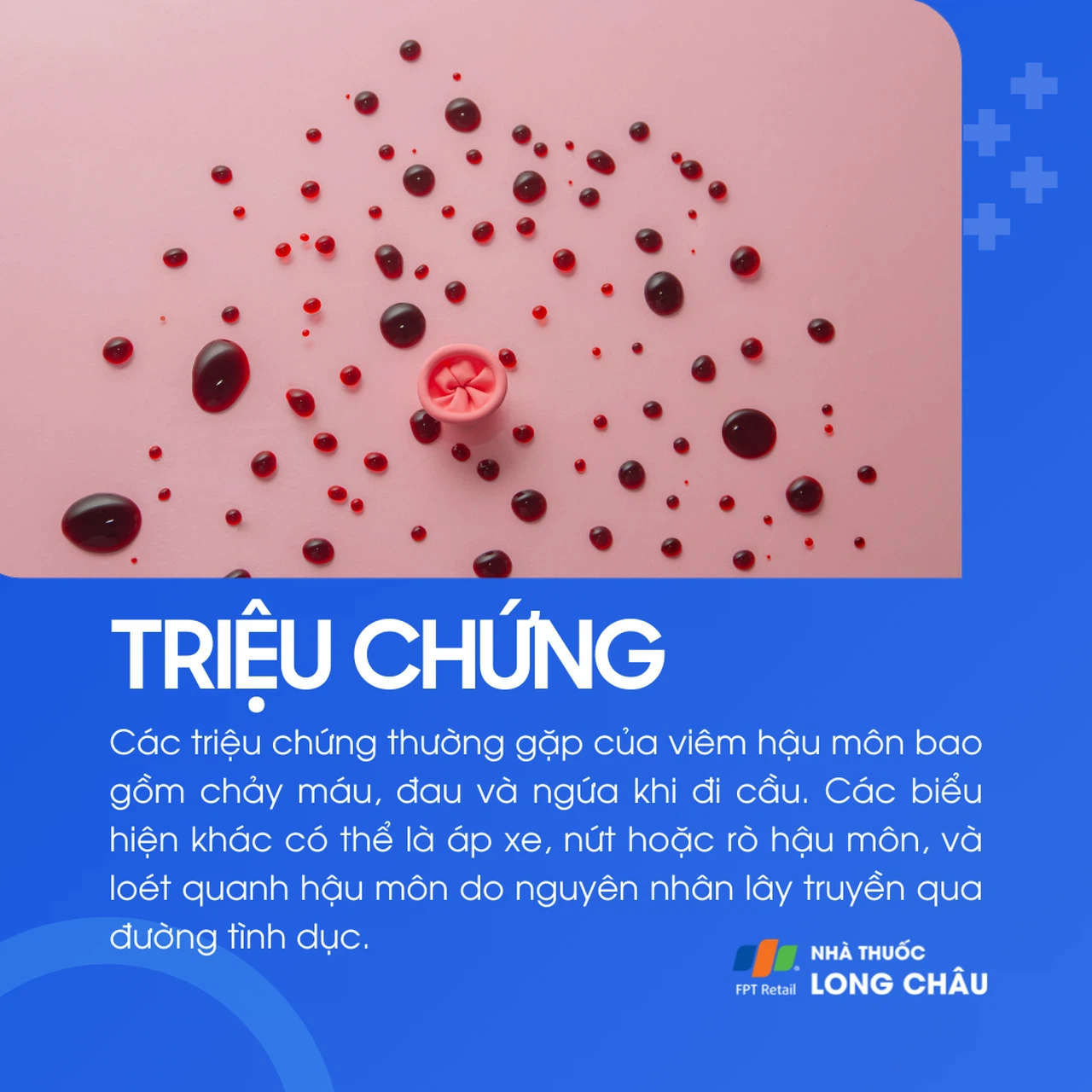 Viêm hậu môn 2