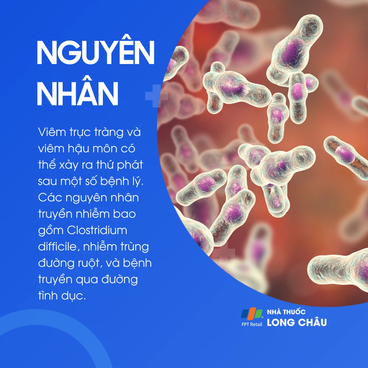 Viêm hậu môn 3
