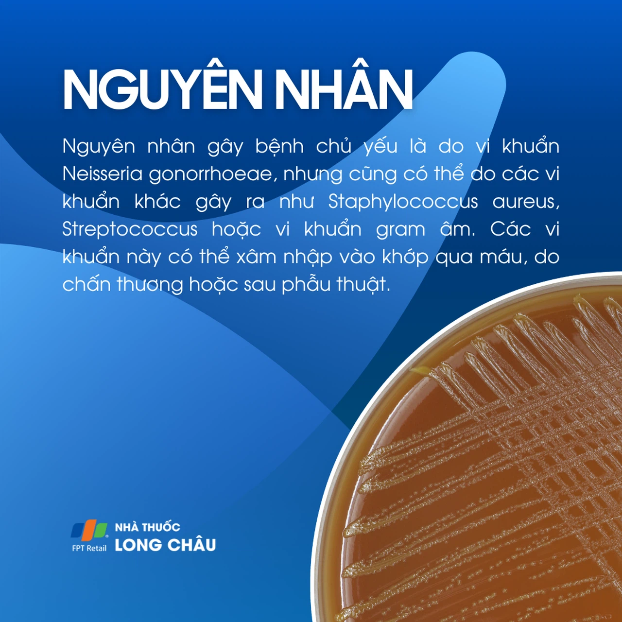 Viêm khớp nhiễm khuẩn sinh mủ 3