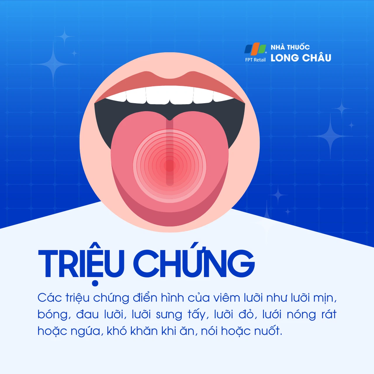 Viêm lưỡi 2