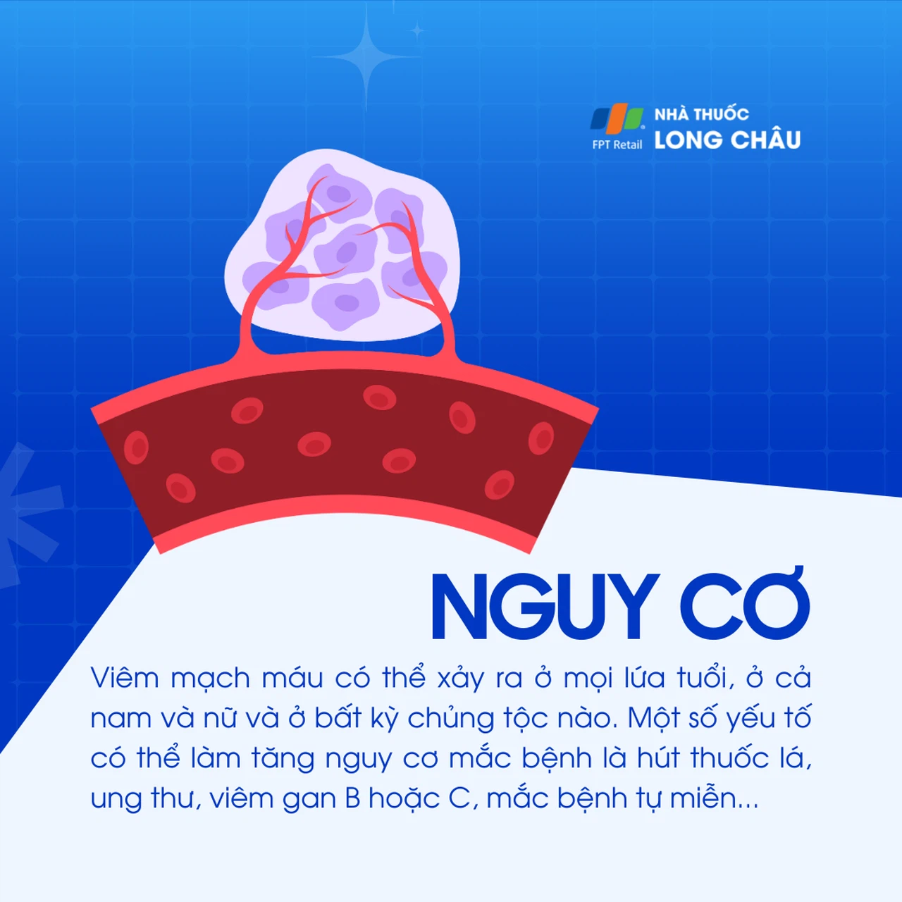 Viêm mạch 4