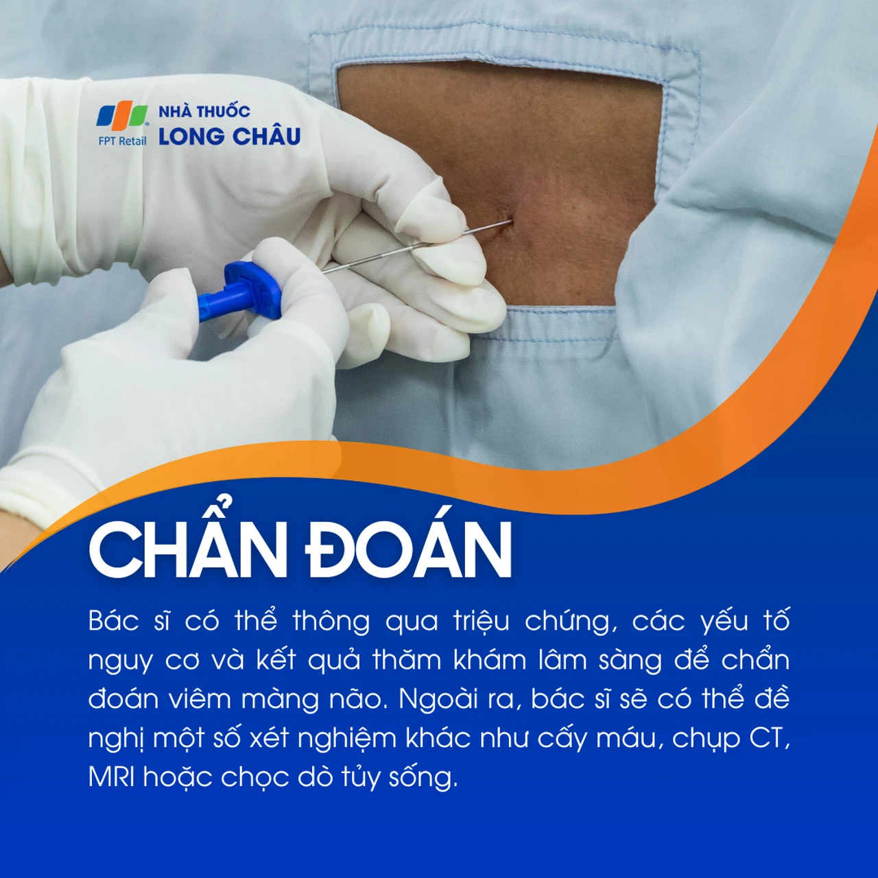Viêm màng não 5
