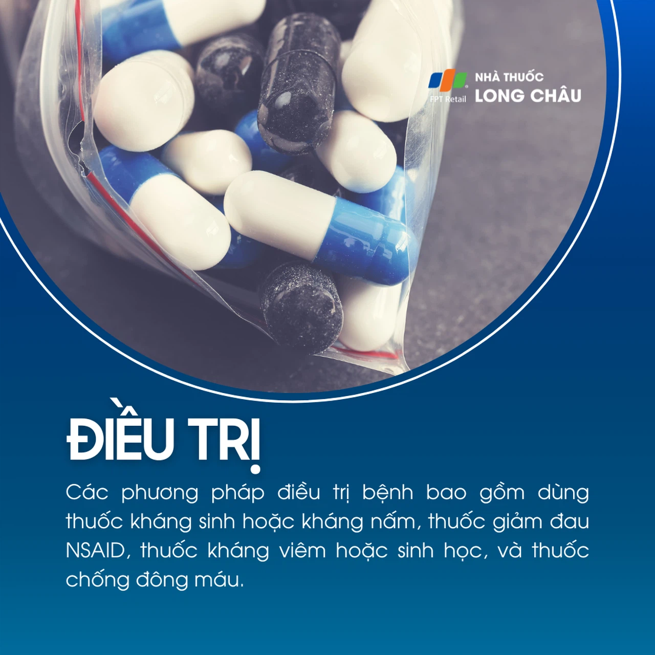 Viêm màng phổi 6