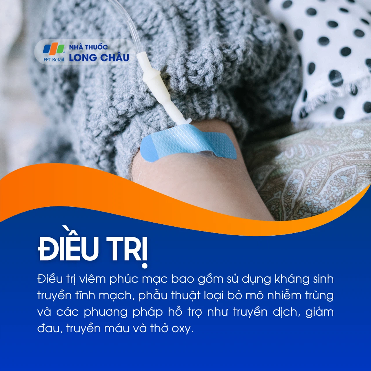 Viêm phúc mạc 6