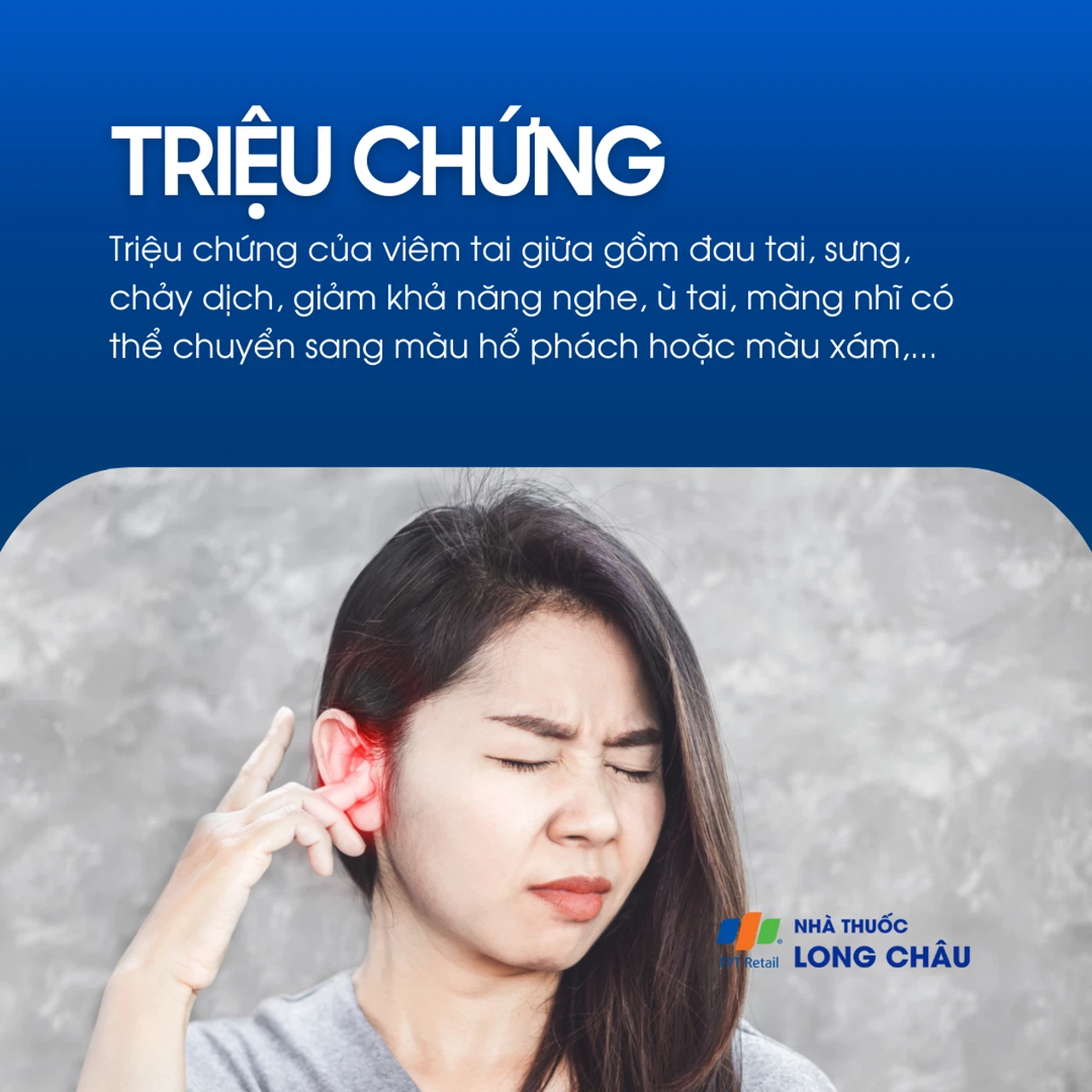 Viêm tai giữa 2