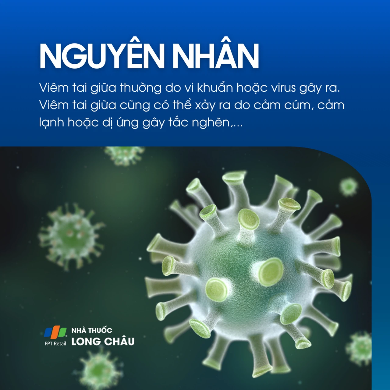 Viêm tai giữa 3