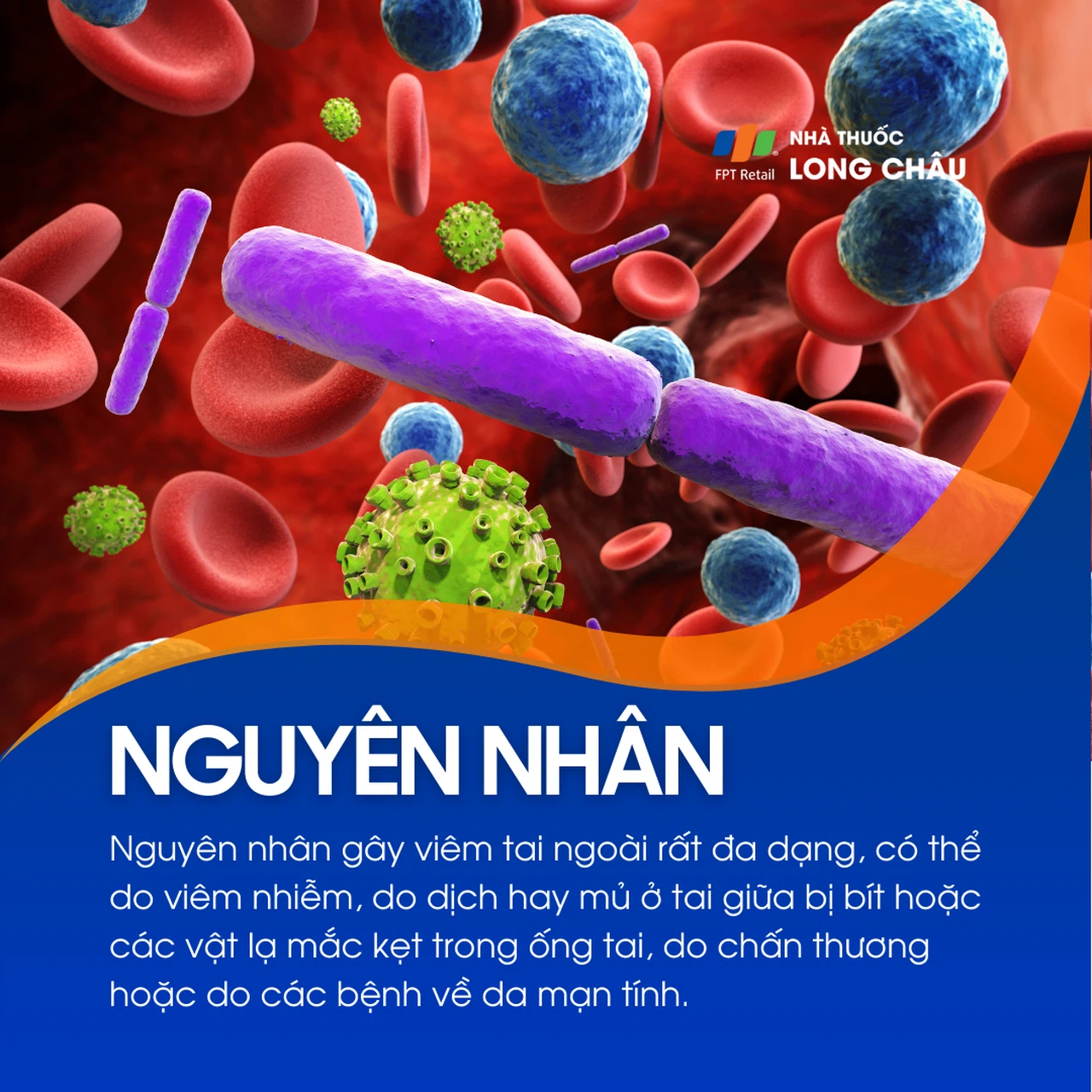 Viêm tai ngoài 3