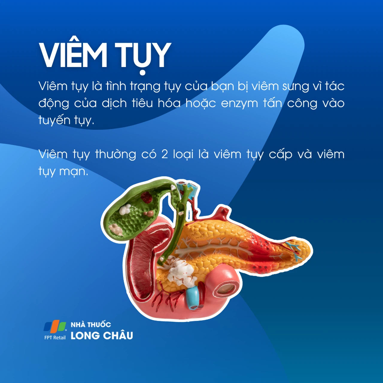 Viêm tụy 1