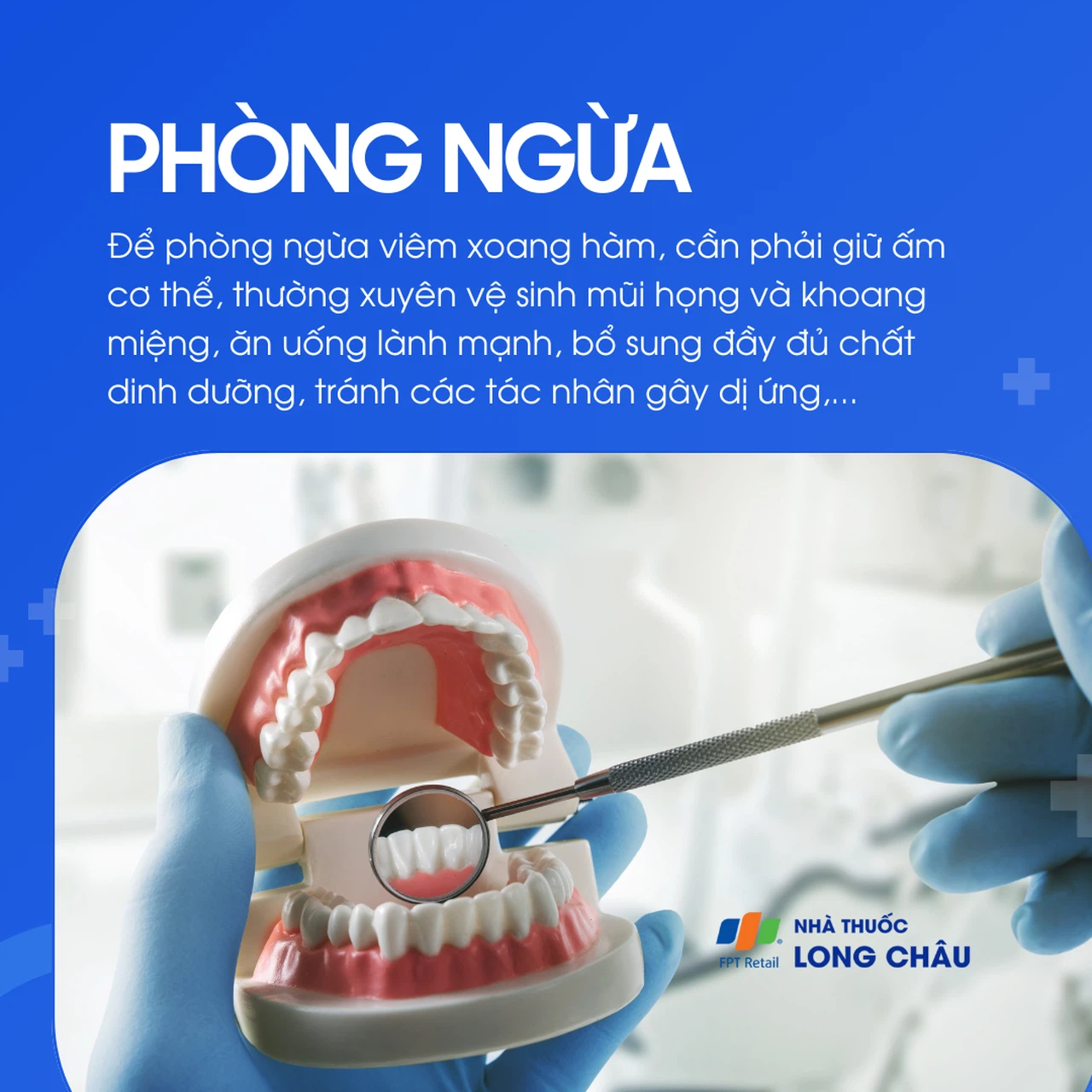 Viêm xoang hàm 7