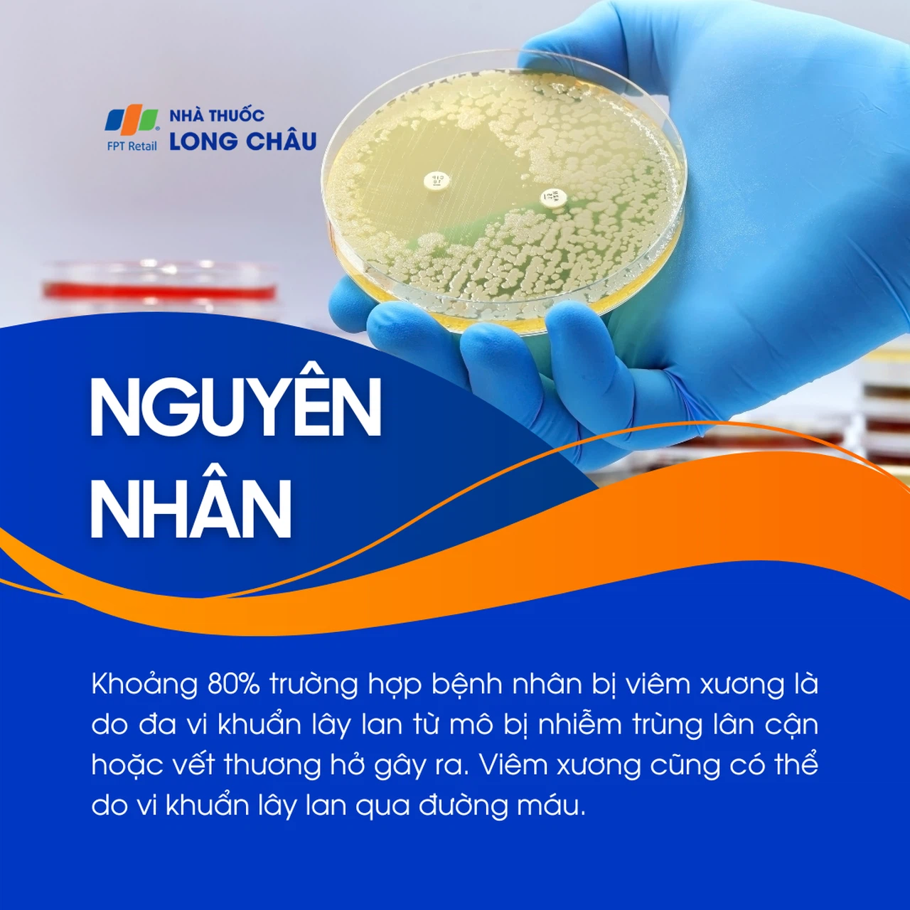 Viêm xương 3
