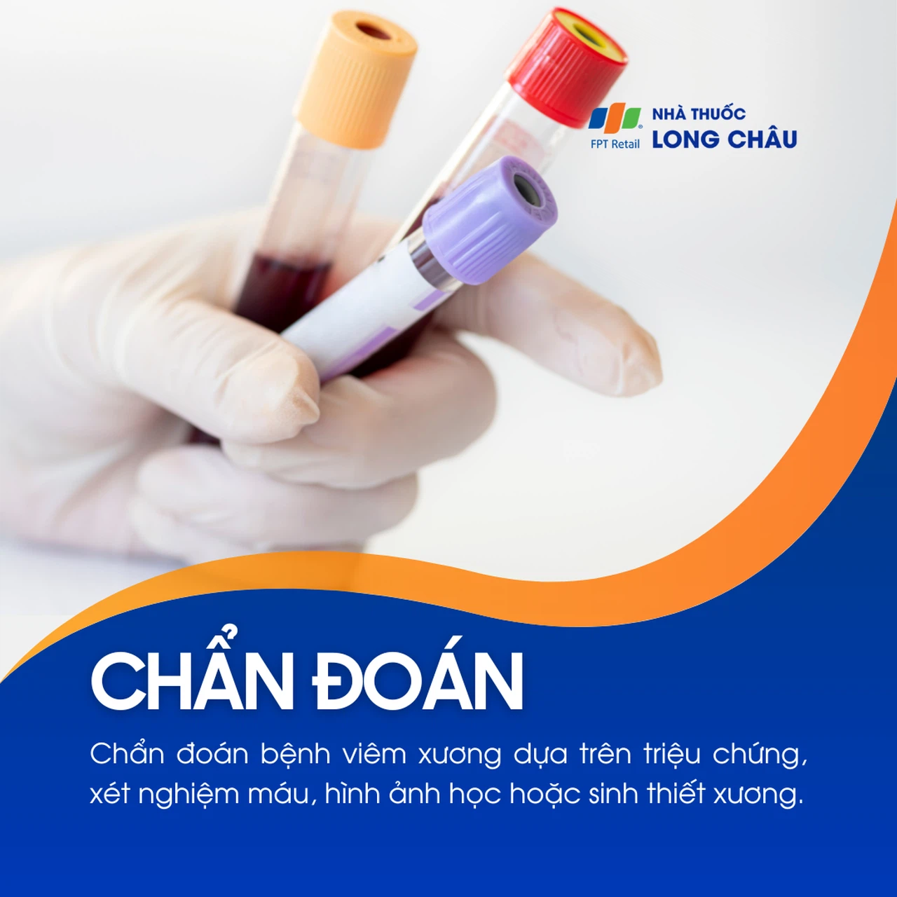 Viêm xương 5