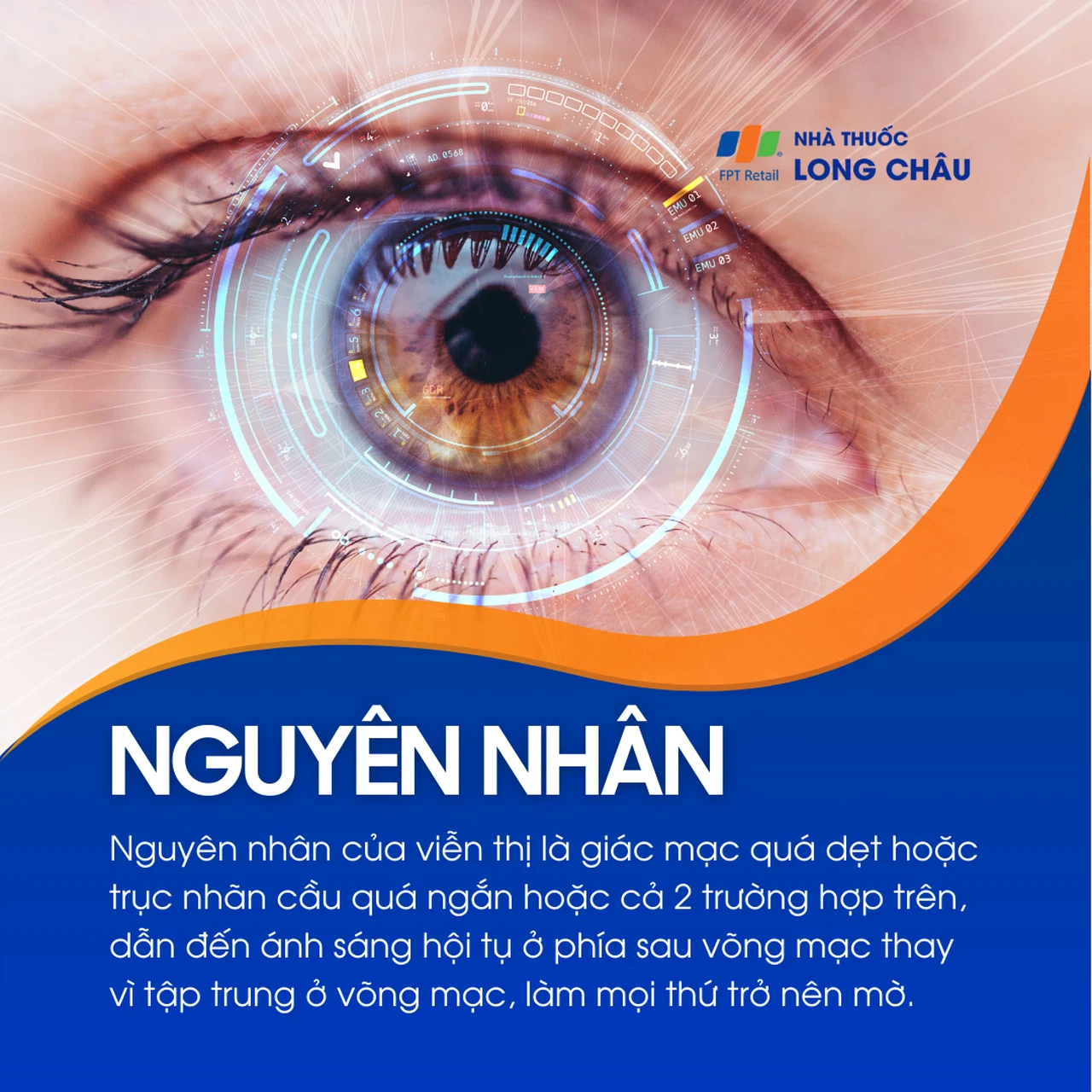 Viễn thị 3