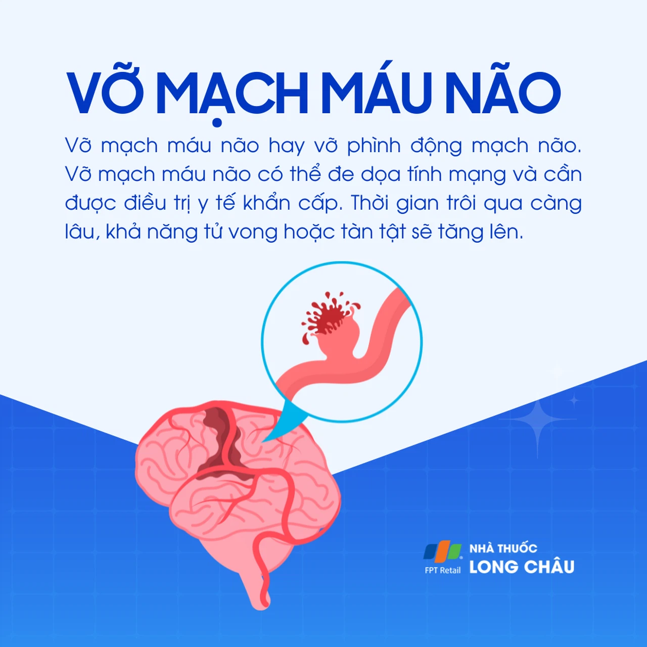 Vỡ mạch máu não 1