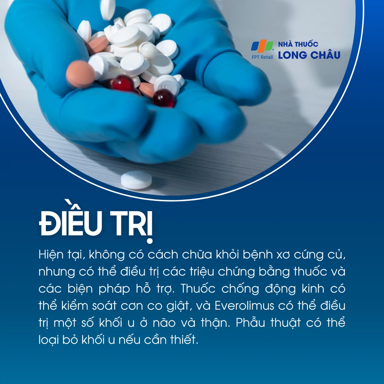 Xơ cứng củ 6