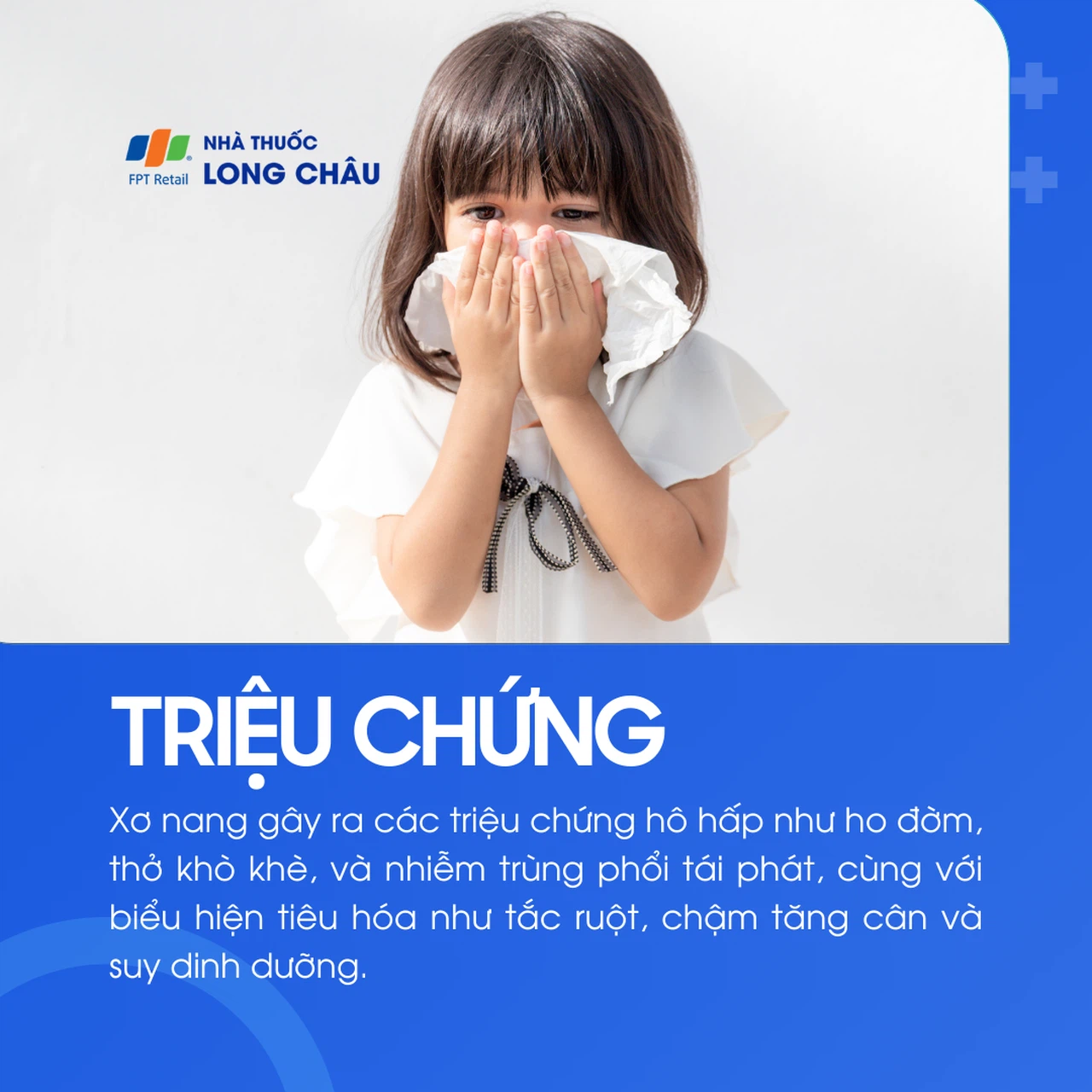 Xơ nang 3