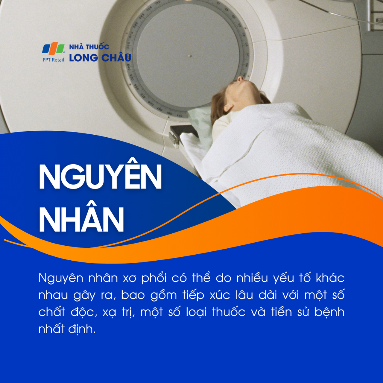 Xơ phổi 3