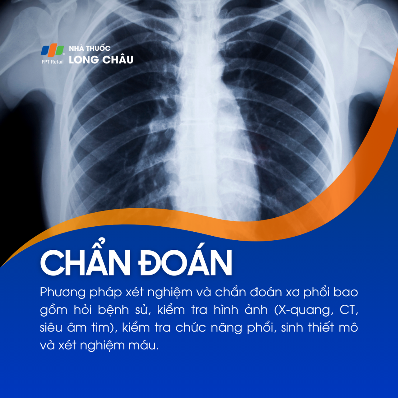 Xơ phổi 5