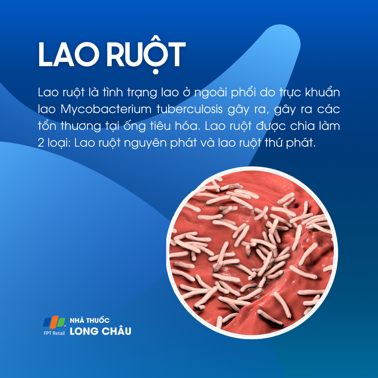 Lao ruột 1