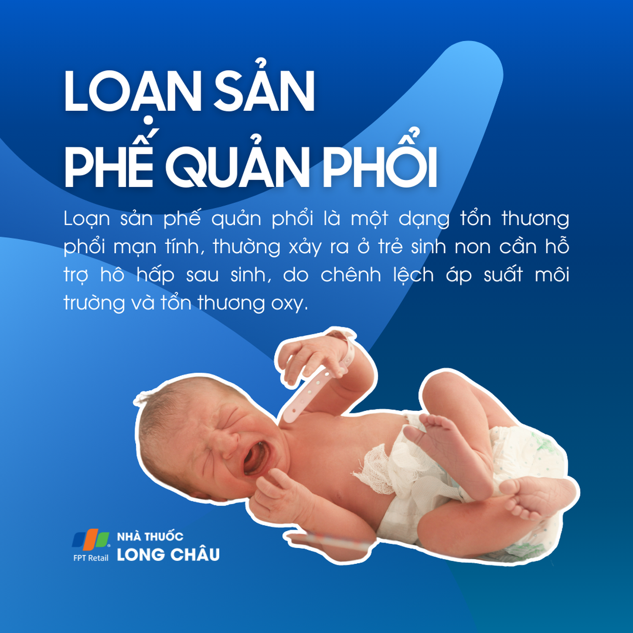 Loạn sản phế quản phổi 1