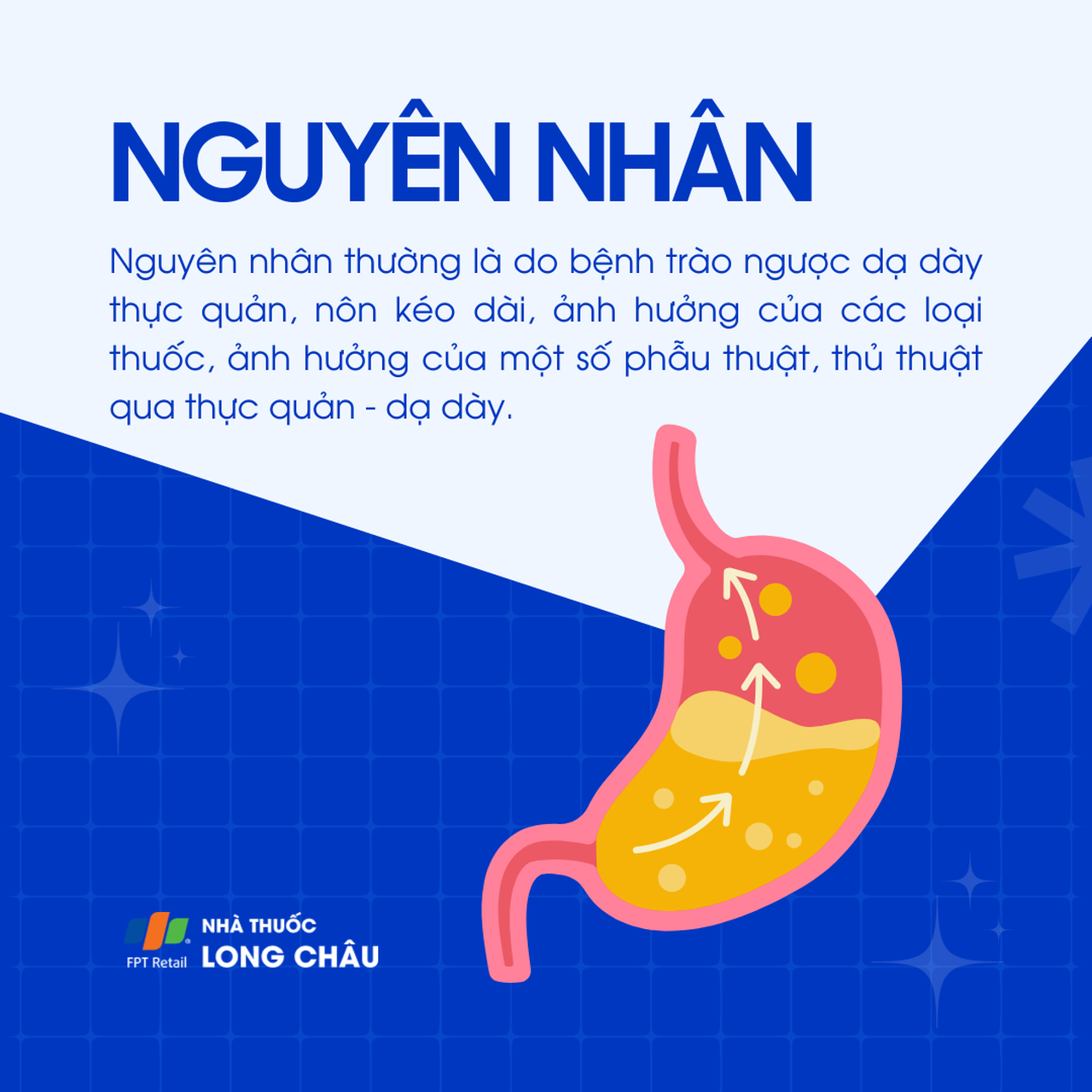 Loét thực quản 2