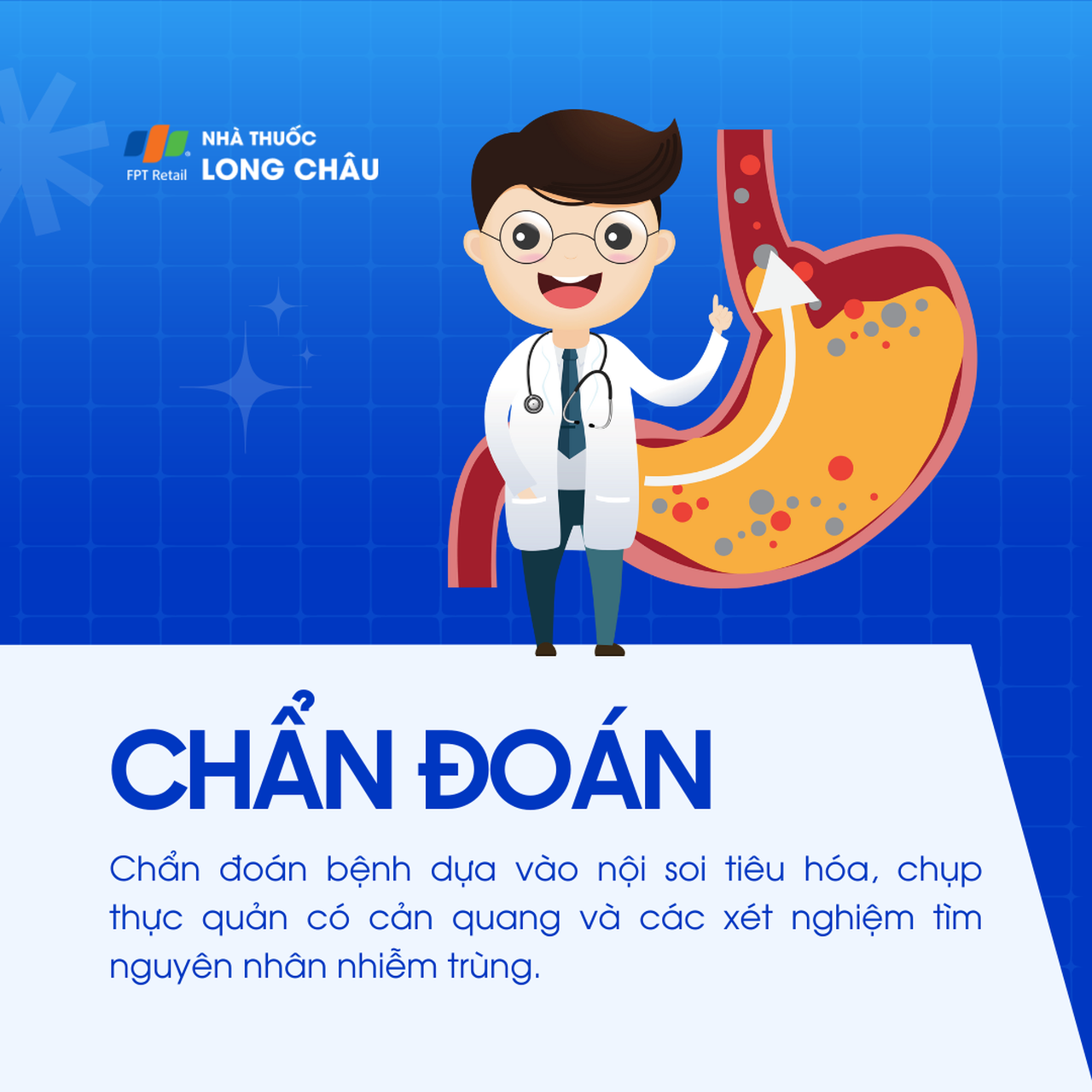 Loét thực quản 5