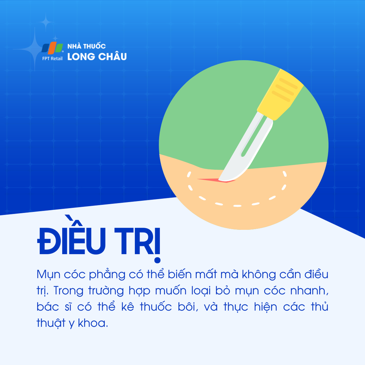 Mụn cóc phẳng  6