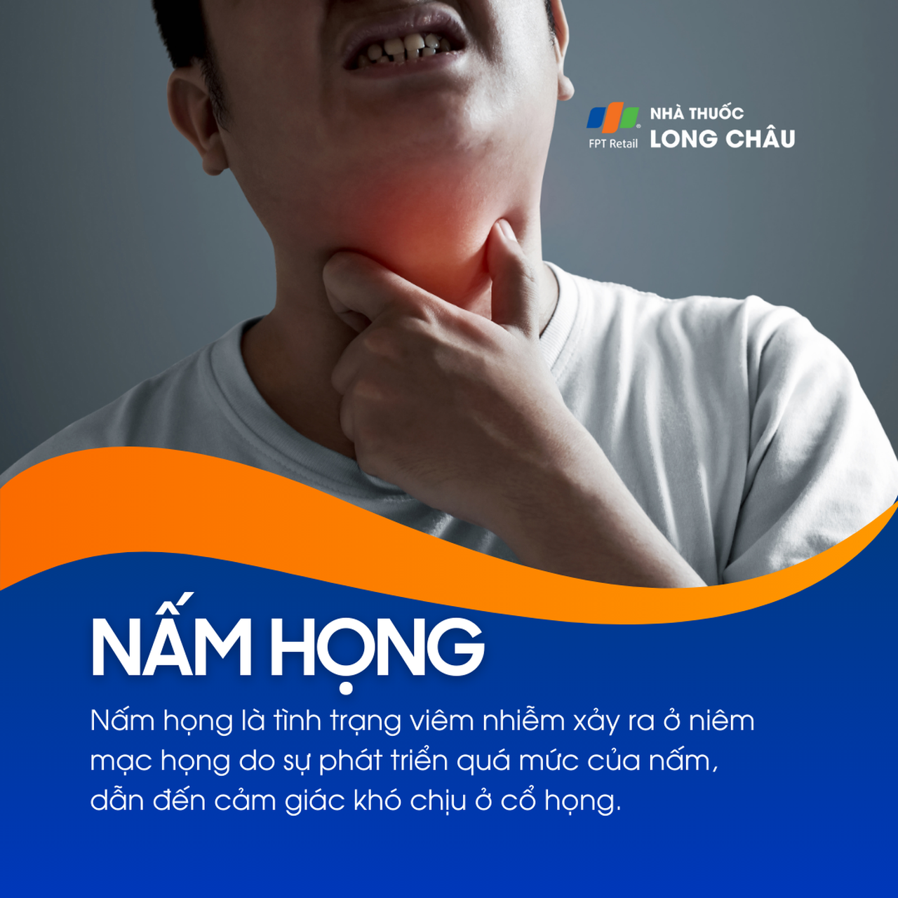 Nấm họng 1