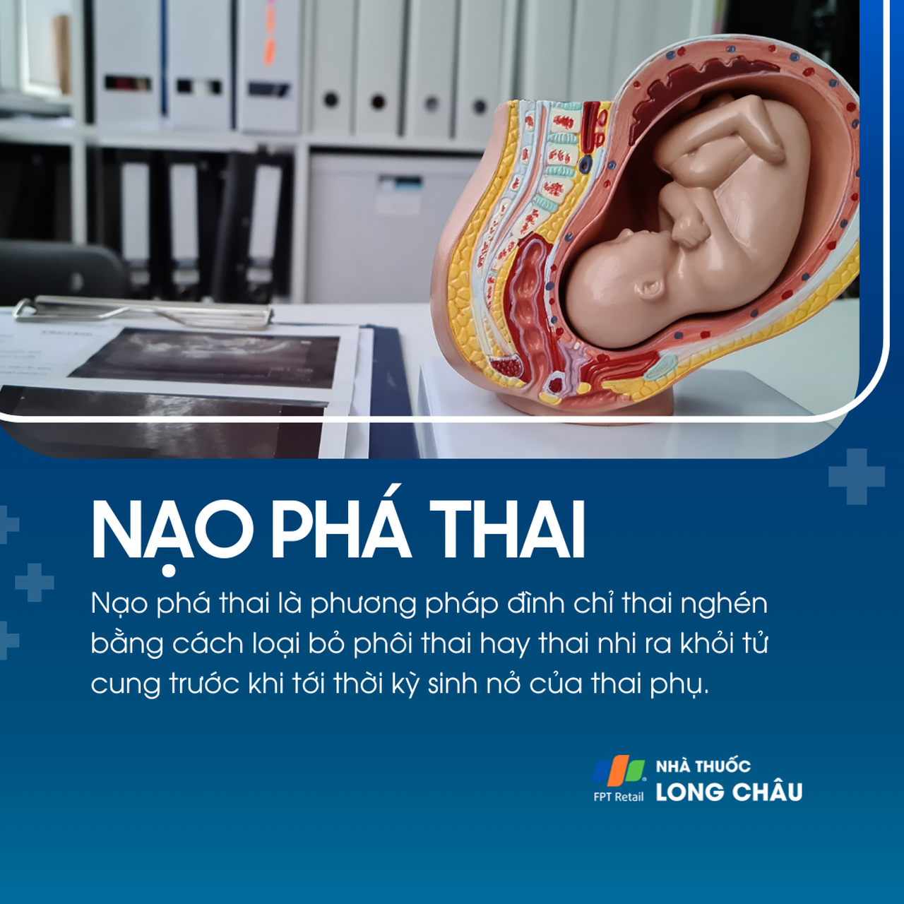 Nạo phá thai 1