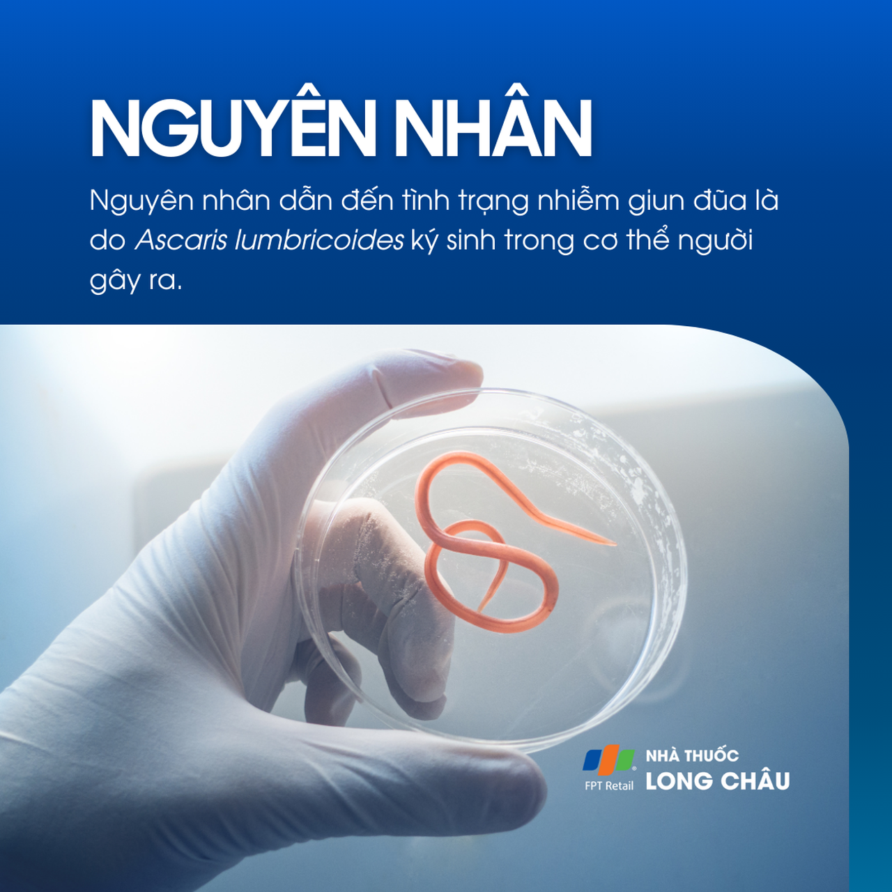 Nhiễm giun đũa 3