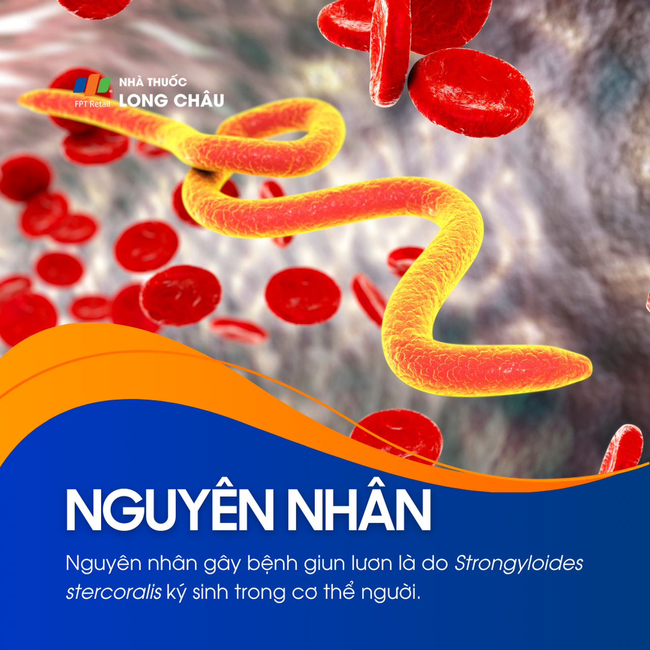 Nhiễm giun lươn 4