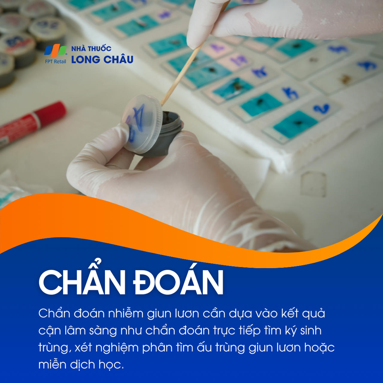 Nhiễm giun lươn 6