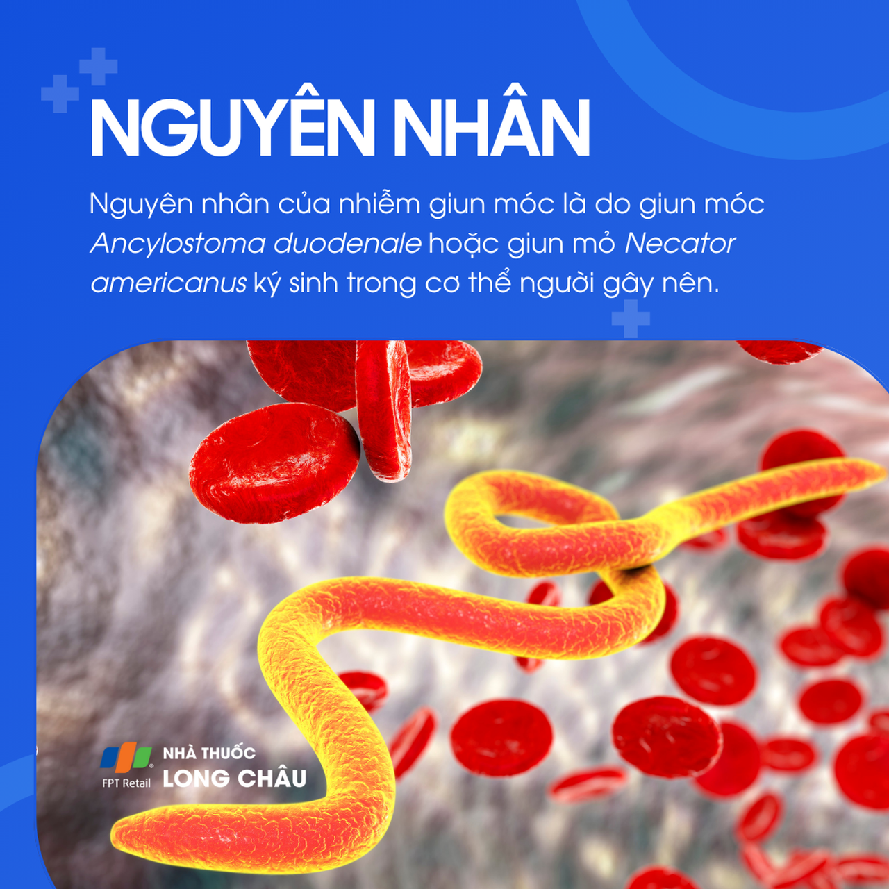 Nhiễm giun móc 3