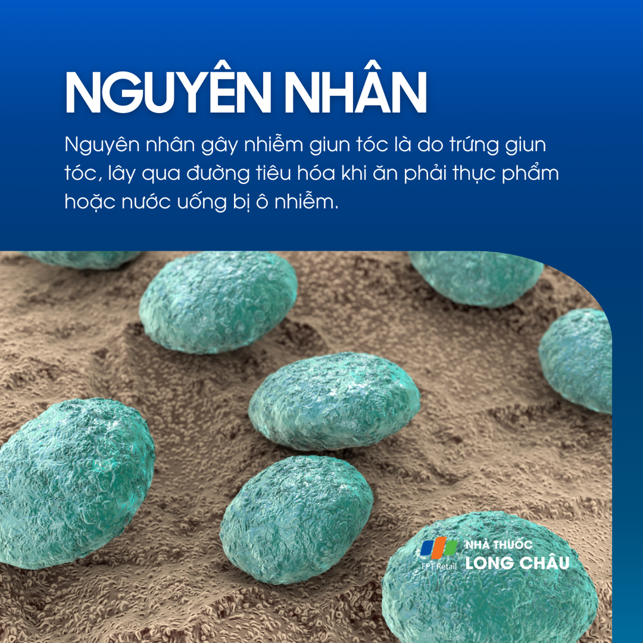 Nhiễm giun tóc 3