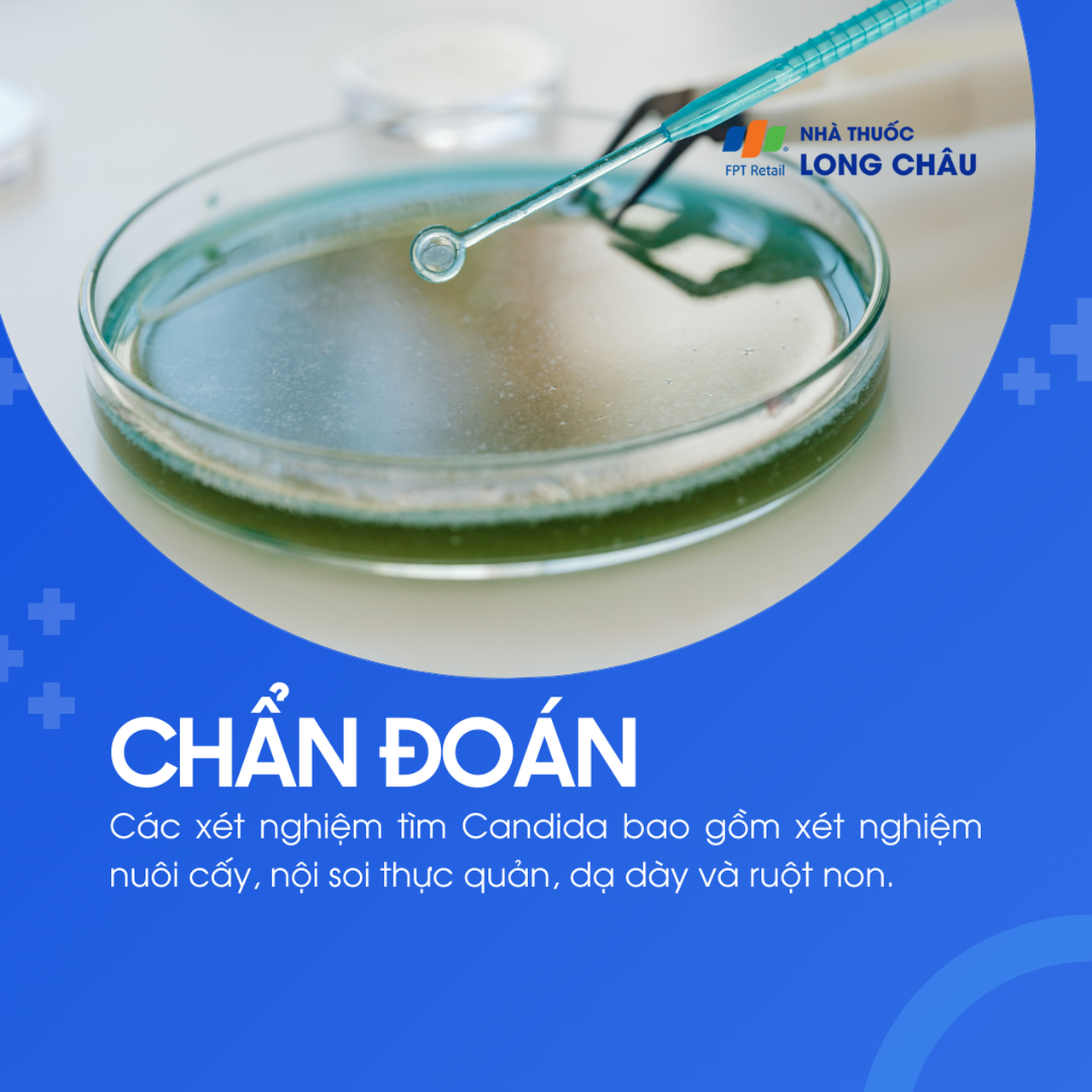 Chẩn đoán nấm Candida qua xét nghiệm nuôi cấy, nội soi thực quản, dạ dày hoặc ruột non