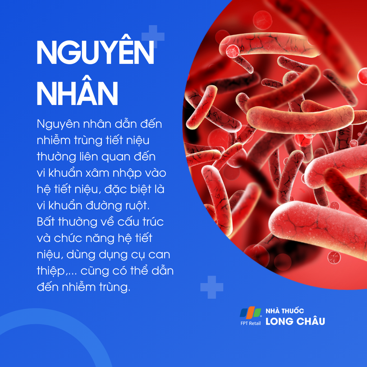 Nhiễm trùng tiết niệu 3