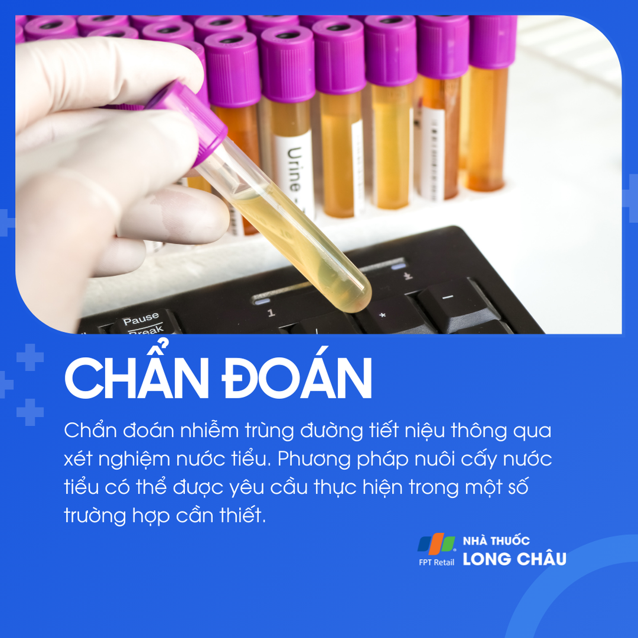 Nhiễm trùng tiết niệu 5