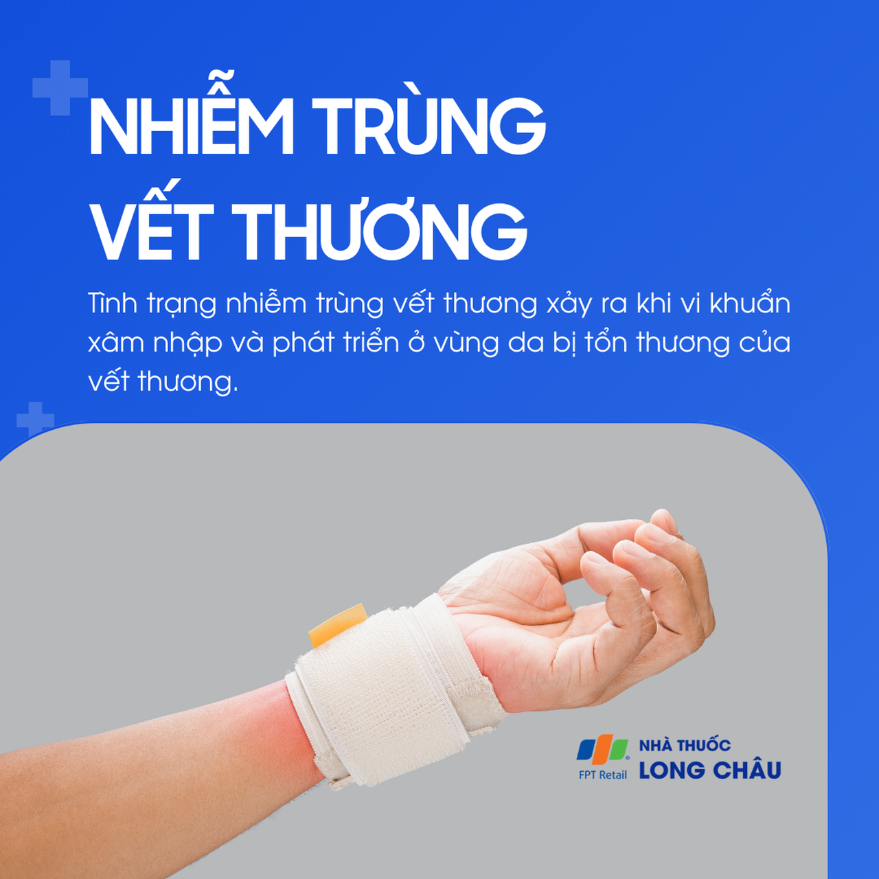Nhiễm trùng vết thương 1