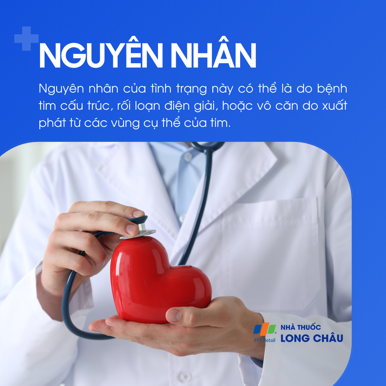 Nhịp nhanh thất 3