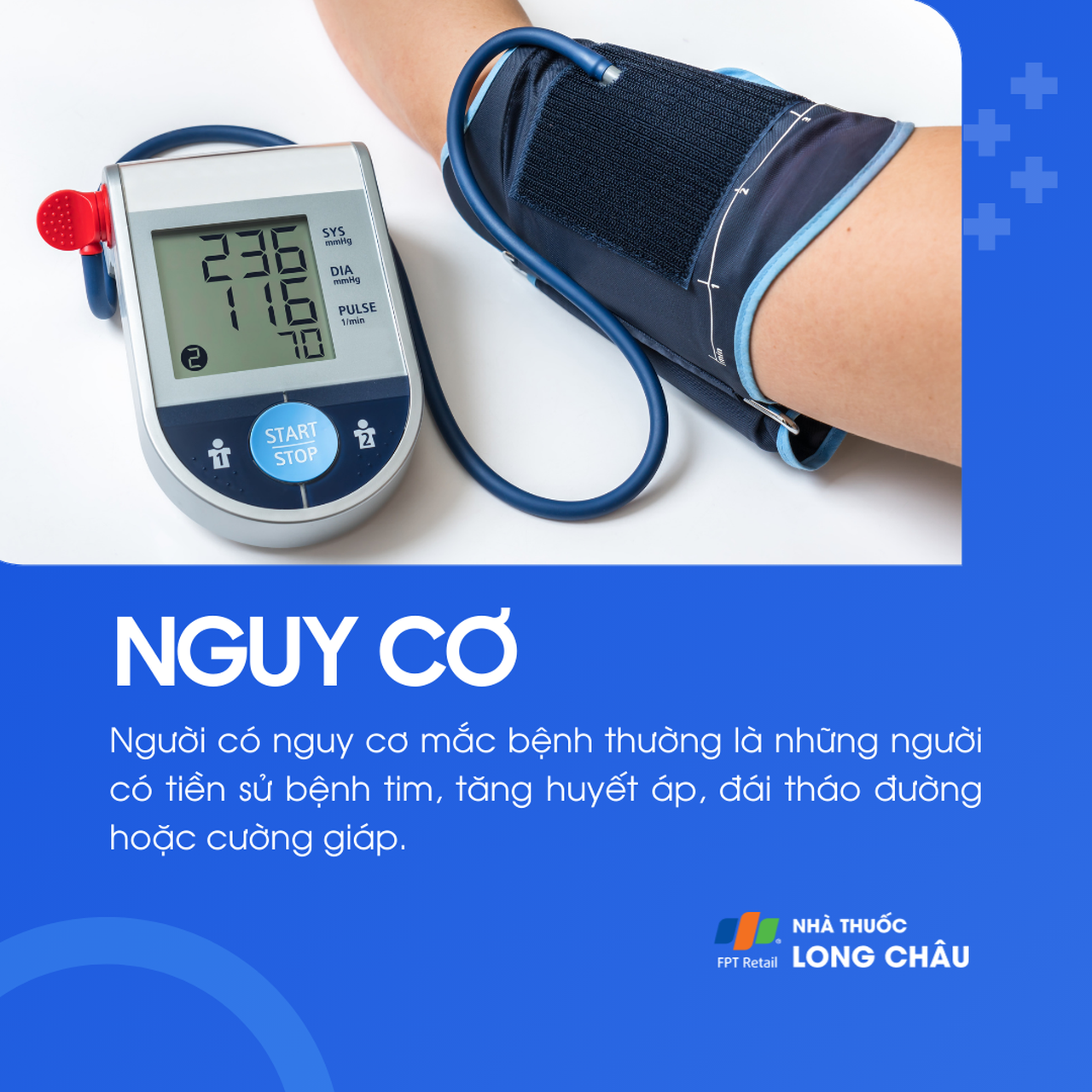 Nhịp nhanh thất 4