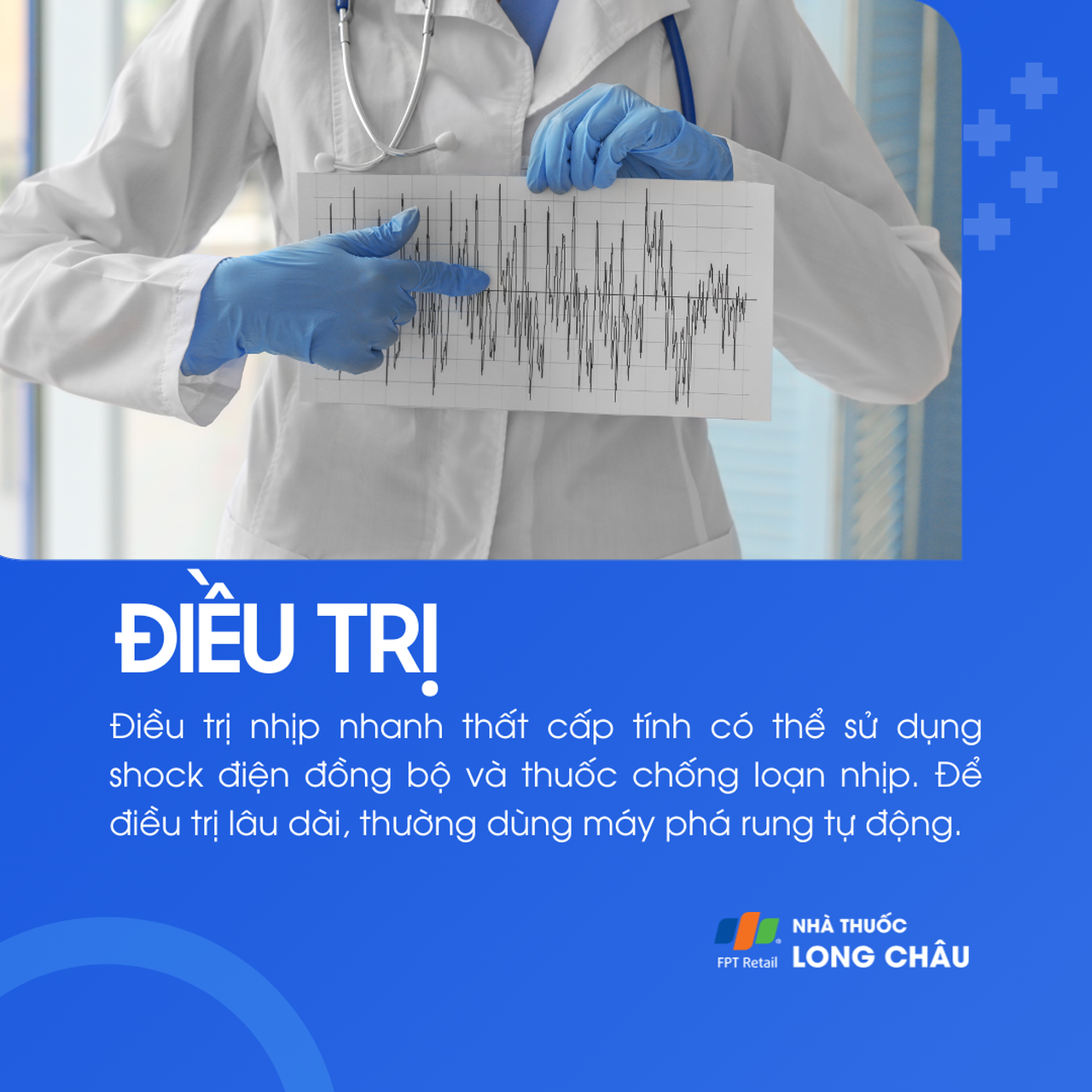 Nhịp nhanh thất 6